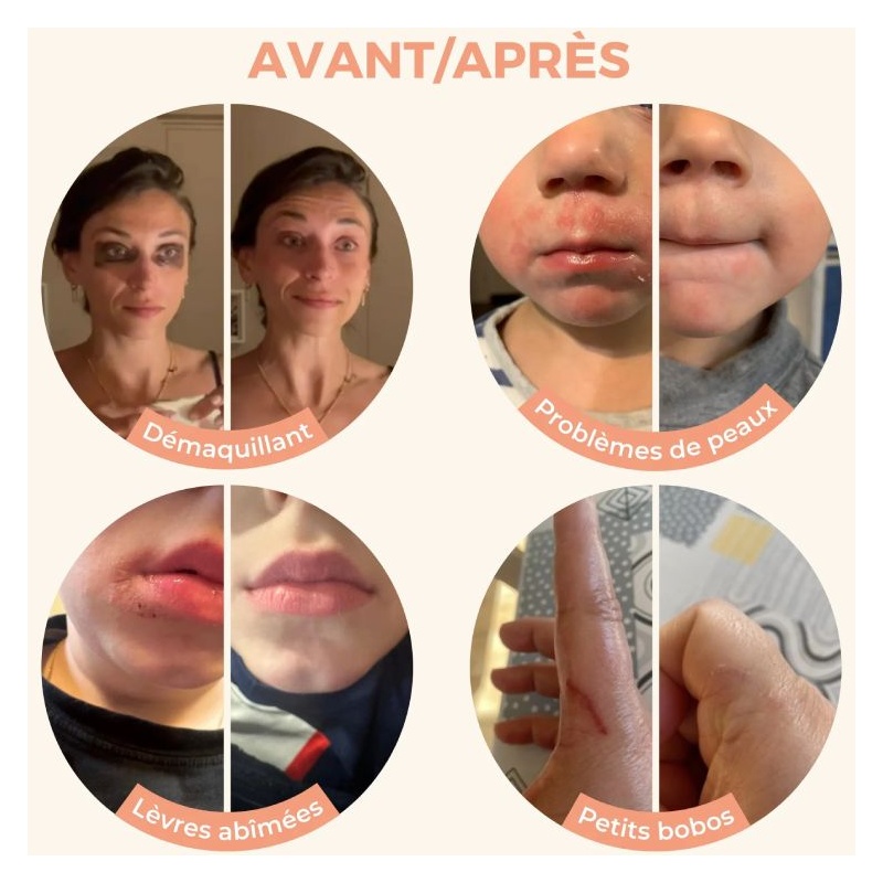 Bienfaits du Baume Magique multi usage Les petits prödiges