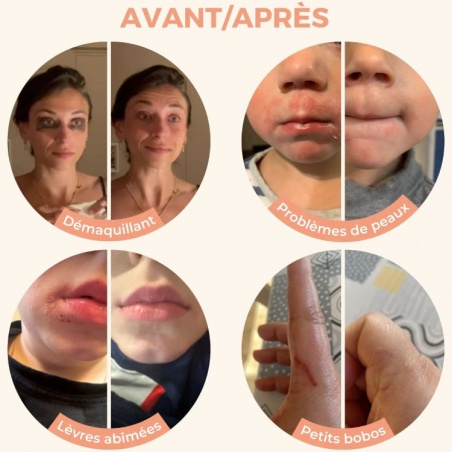 Bienfaits du Baume Magique multi usage Les petits prödiges