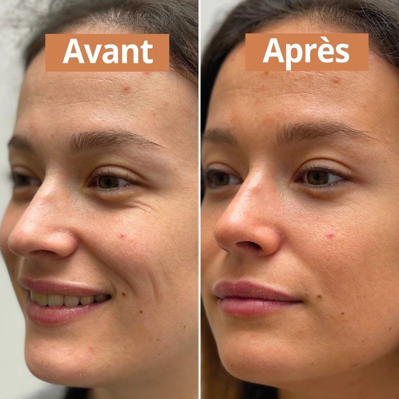 Sérum autobronzant visage & corps Bio - 50ml