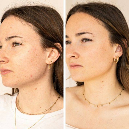 Sérum anti-imperfections : Avant / Après